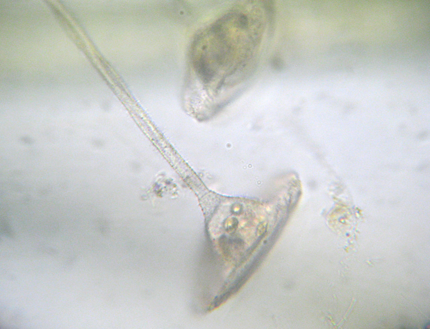 Forse Vorticella patellina